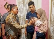 Mikhayla, Balita Yang Berjuang Melawan Kanker Mata, Mendapat Perhatian Khusus Dari Wakil Wali Kota Medan
